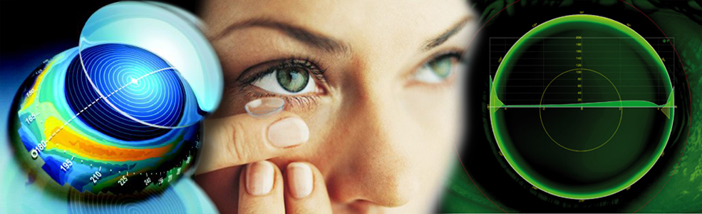 színes kontaktlencse használata rövidlátás esetén romlott az egyik szem látása