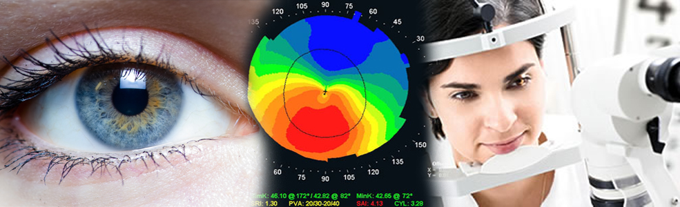 Szemlátomás OptikaA fejfájások szemészeti vonatkozásai - Szemlátomás Optika