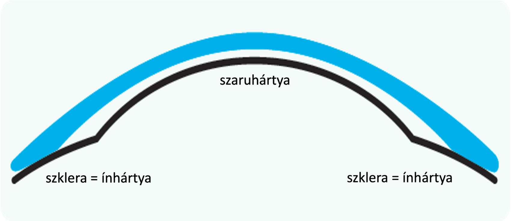 A szklerális kontaktlencse és a szaruhártya helyzete
